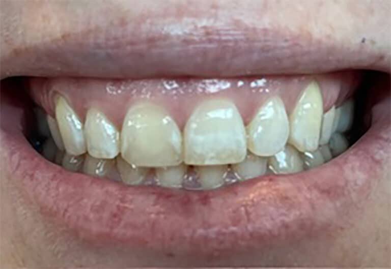 Before Image: Kiley - front