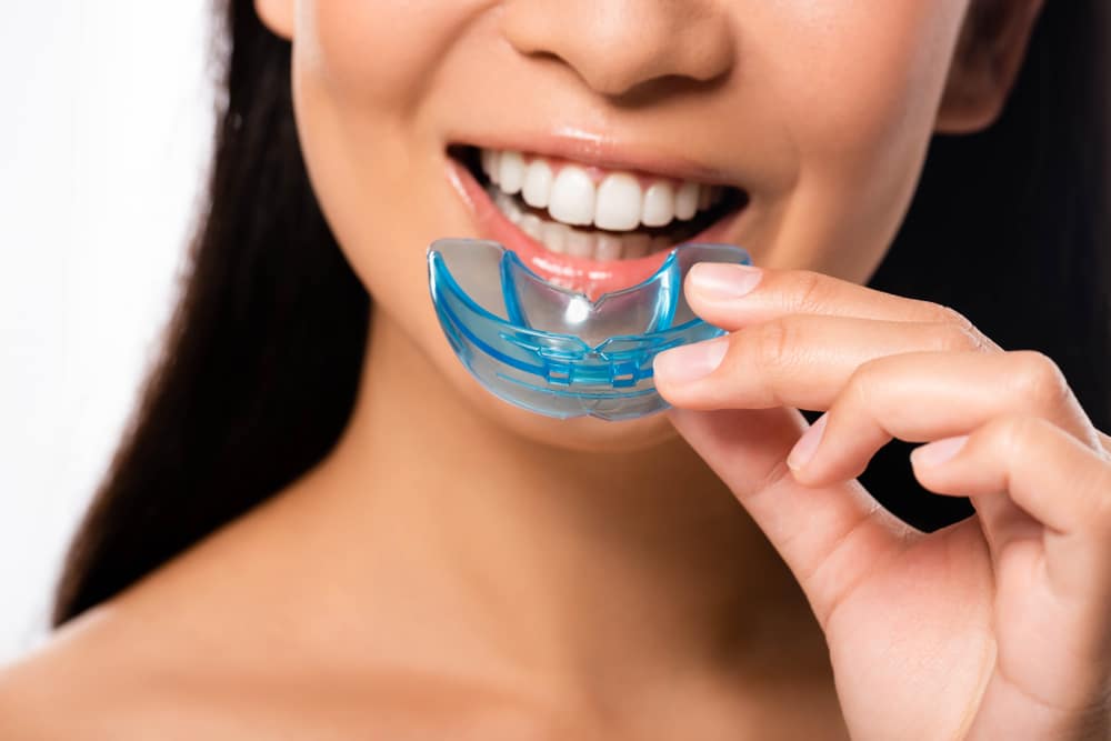 Custom Mouthguard, Collins Dentistry & Aesthetics Spokane, WA