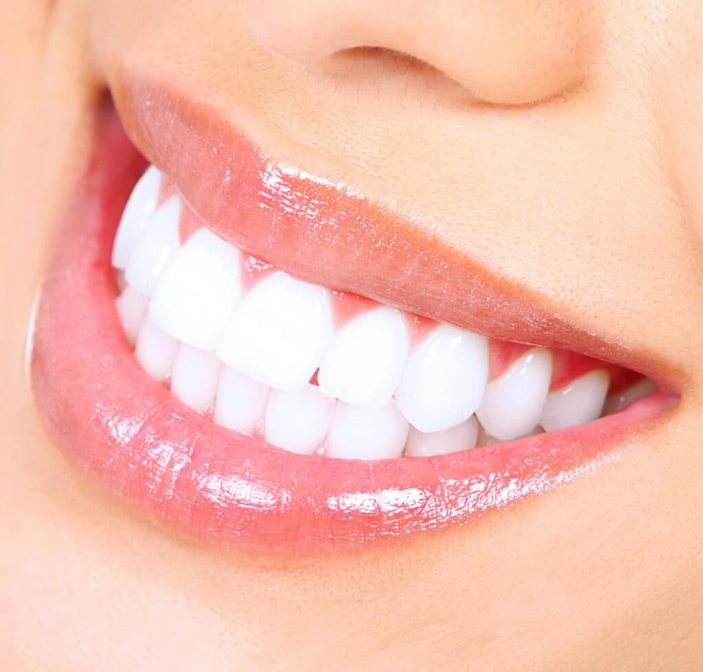 Close up of very white, bright teeth from professional teeth whitening treatment