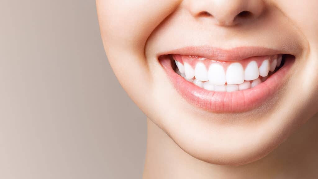 A close-up shot of a woman smiling after getting white fillings in Spokane