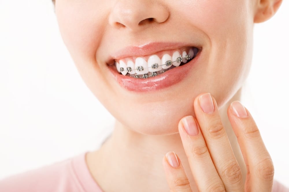 Dental Braces Treatment Spokane WA