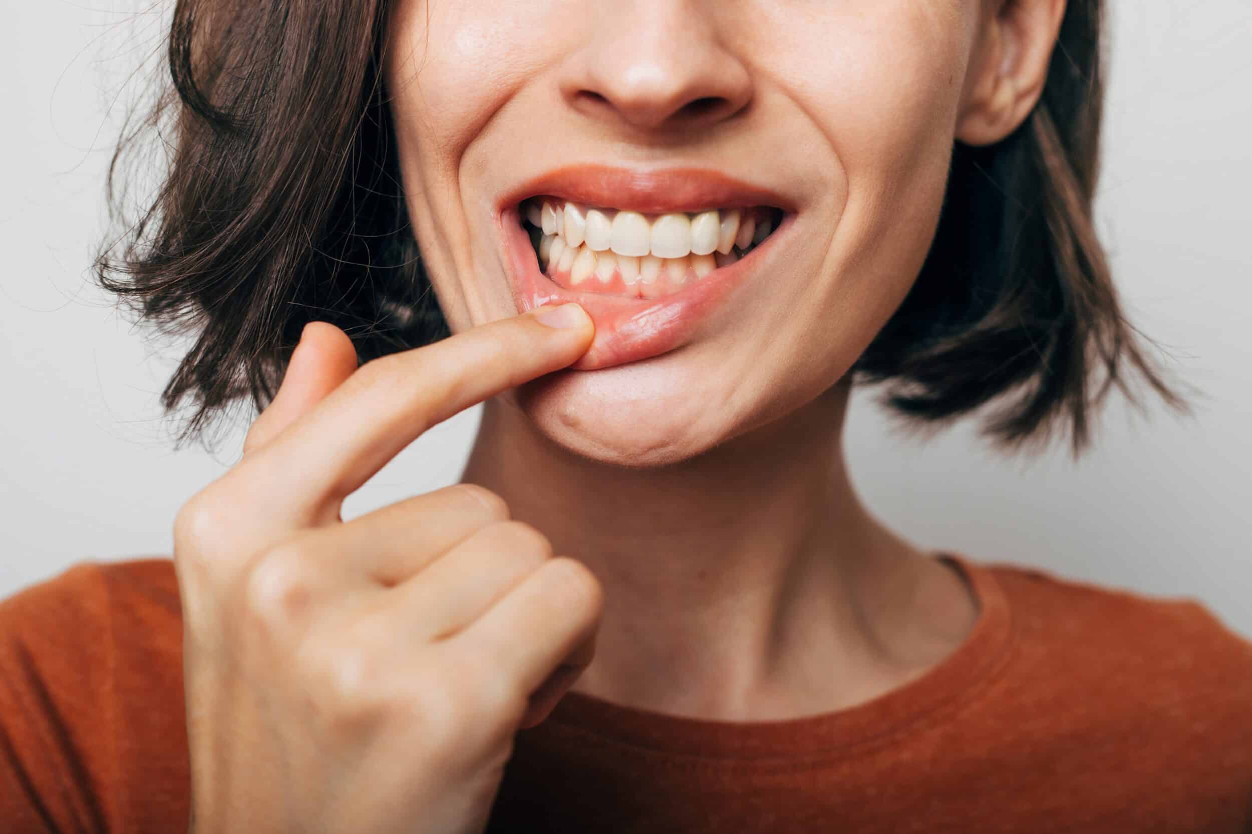 A close-up shot of a woman’s teeth after gum disease treatment in Spokane