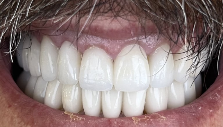 After Image: Kevin - front